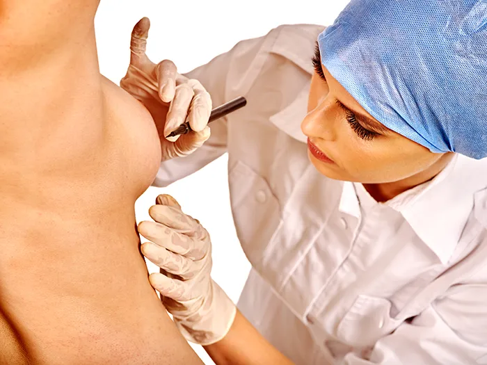 nipple correction