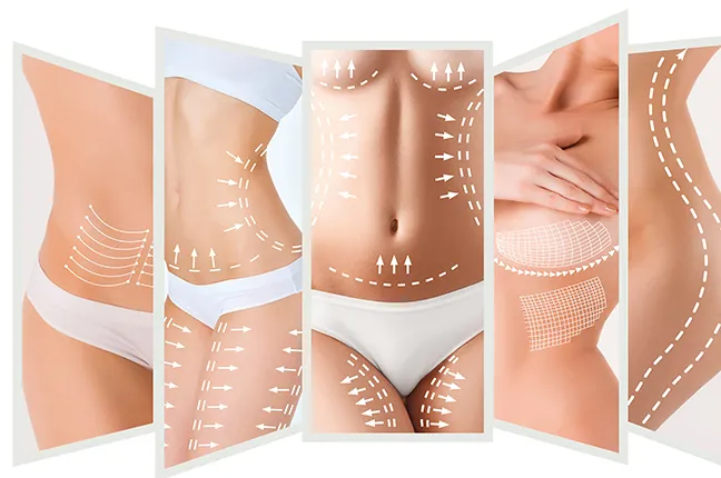 popular cosmetic surgery