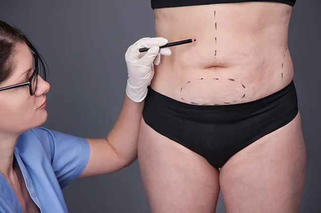 understanding vaser liposuction