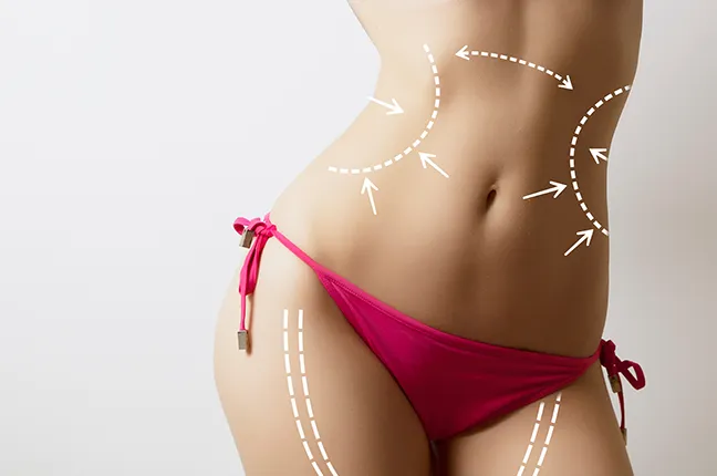 vaser liposuction prices